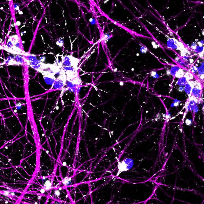 Purple neurons with mitochondria