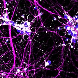 Purple neurons with mitochondria