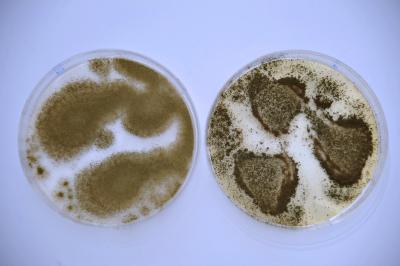 <i>Aspergillus oryzae & flavus</i>