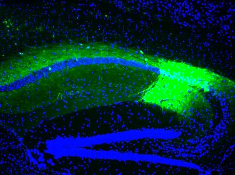 Mouse Hippocampus