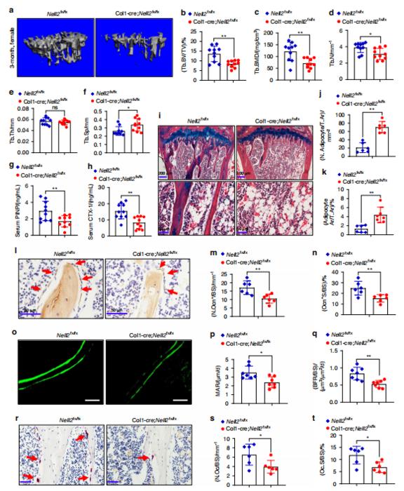 Preosteoblast-specific deletion of NELL2 reduced bone mass in female mice.