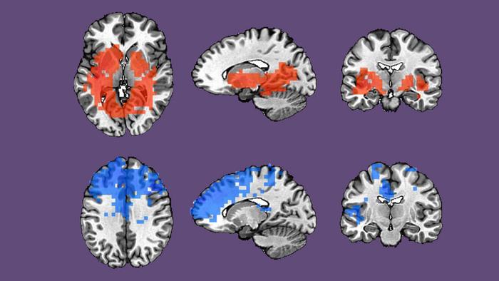 Brain wave activity