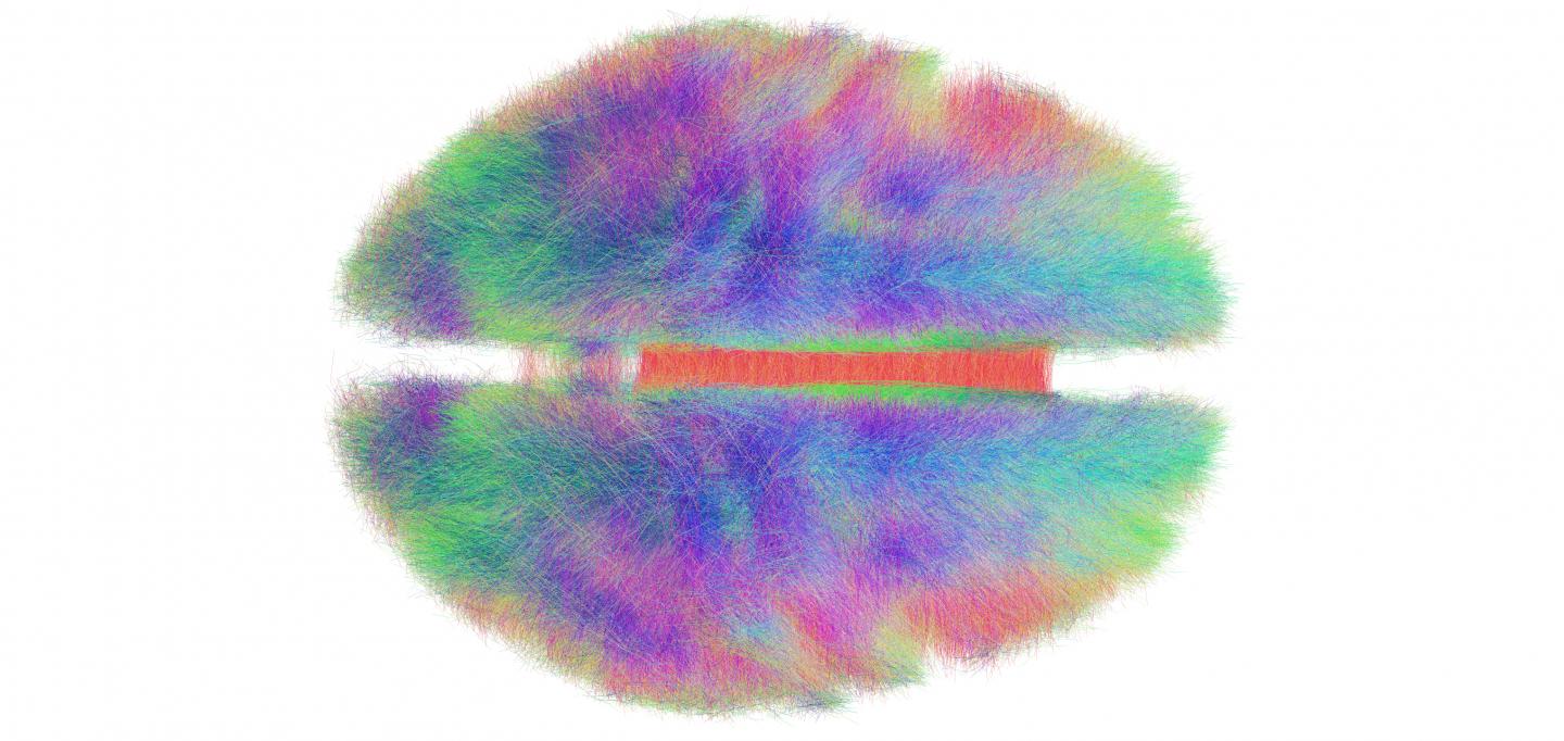 The Human Connectome