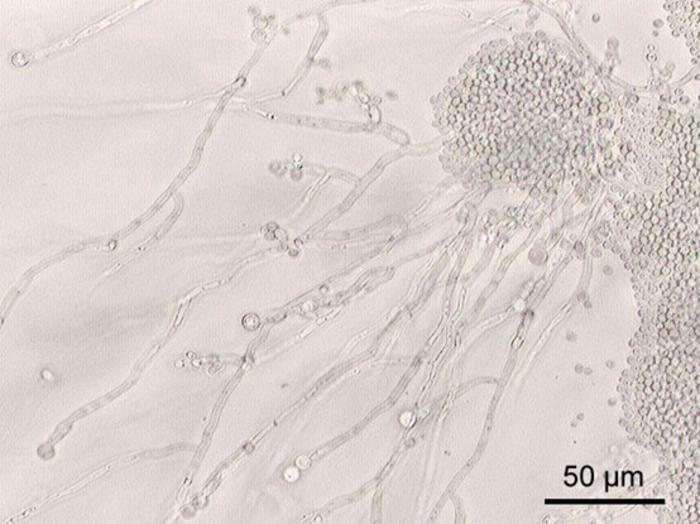 Host Immune System Recognition of Candidalysin