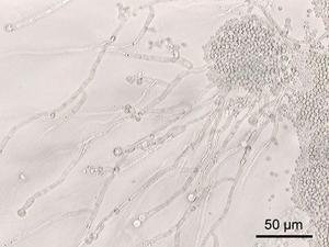 Host Immune System Recognition of Candidalysin