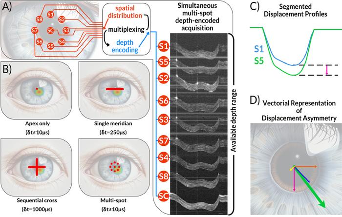 Comparison of conventional OCT approaches with a new multi-spot method that simultaneously measures air-puff-induced corneal deformation at nine locations. This enables assessment of corneal asymmetry, relevant particularly to keratoconus