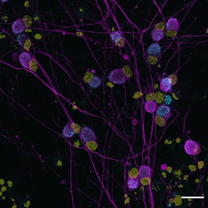 Human neurons