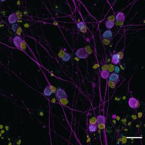 Human neurons