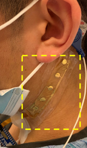 Cervical nerve monitor