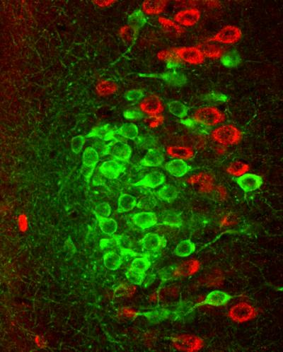 Island Cells Make Clusters in Entorhinal Cortex Layer II