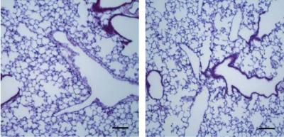 Lipid Molecules Linked to Childhood Asthma
