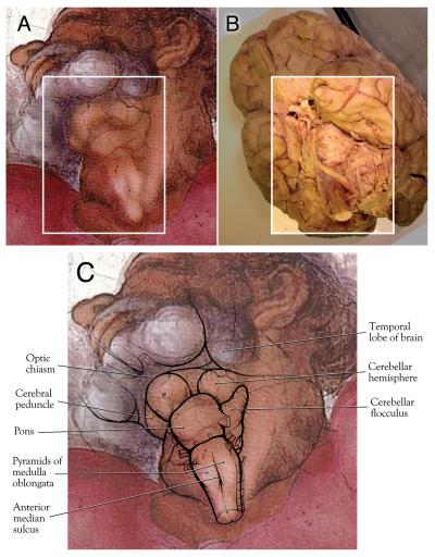 Brainstem