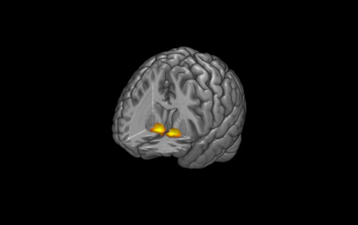 Depression Buffer