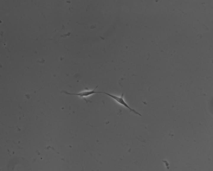 Two Stem Cells