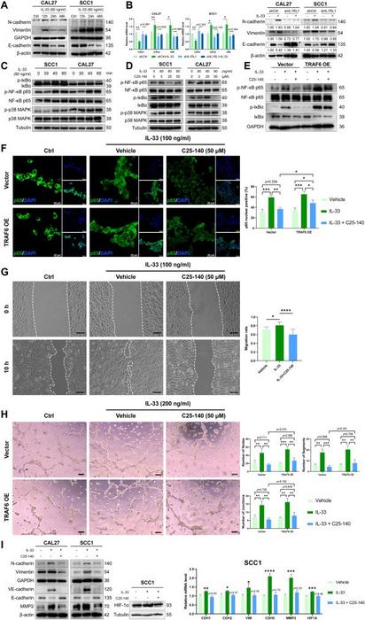 TRAF6 inhibition suppresses the IL-33/ST2-triggered vasculogenic mimicry (VM) and epithelial–mesenchymal transition (EMT) in vitro