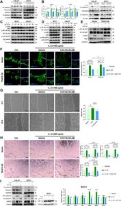 TRAF6 inhibition suppresses the IL-33/ST2-triggered vasculogenic mimicry (VM) and epithelial–mesenchymal transition (EMT) in vitro