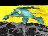 Complex Structure of an Area of Active Fibrosis