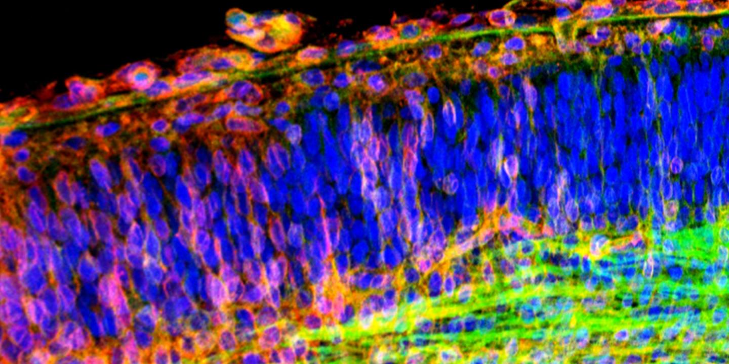 Developing Brain