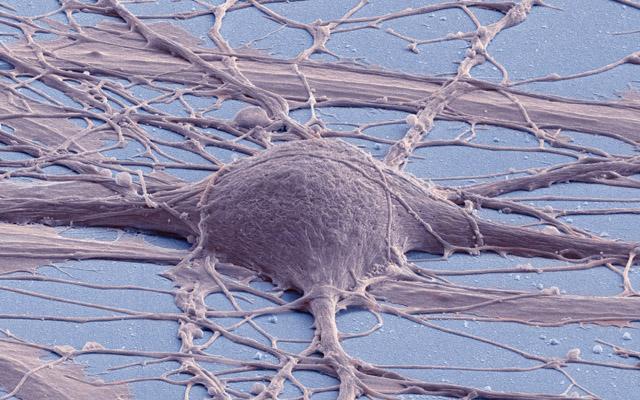 Human Derived Induced Pluripotent Stem Cell, UC San Diego