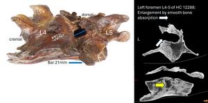 Lumbar vertebrae HC 12288