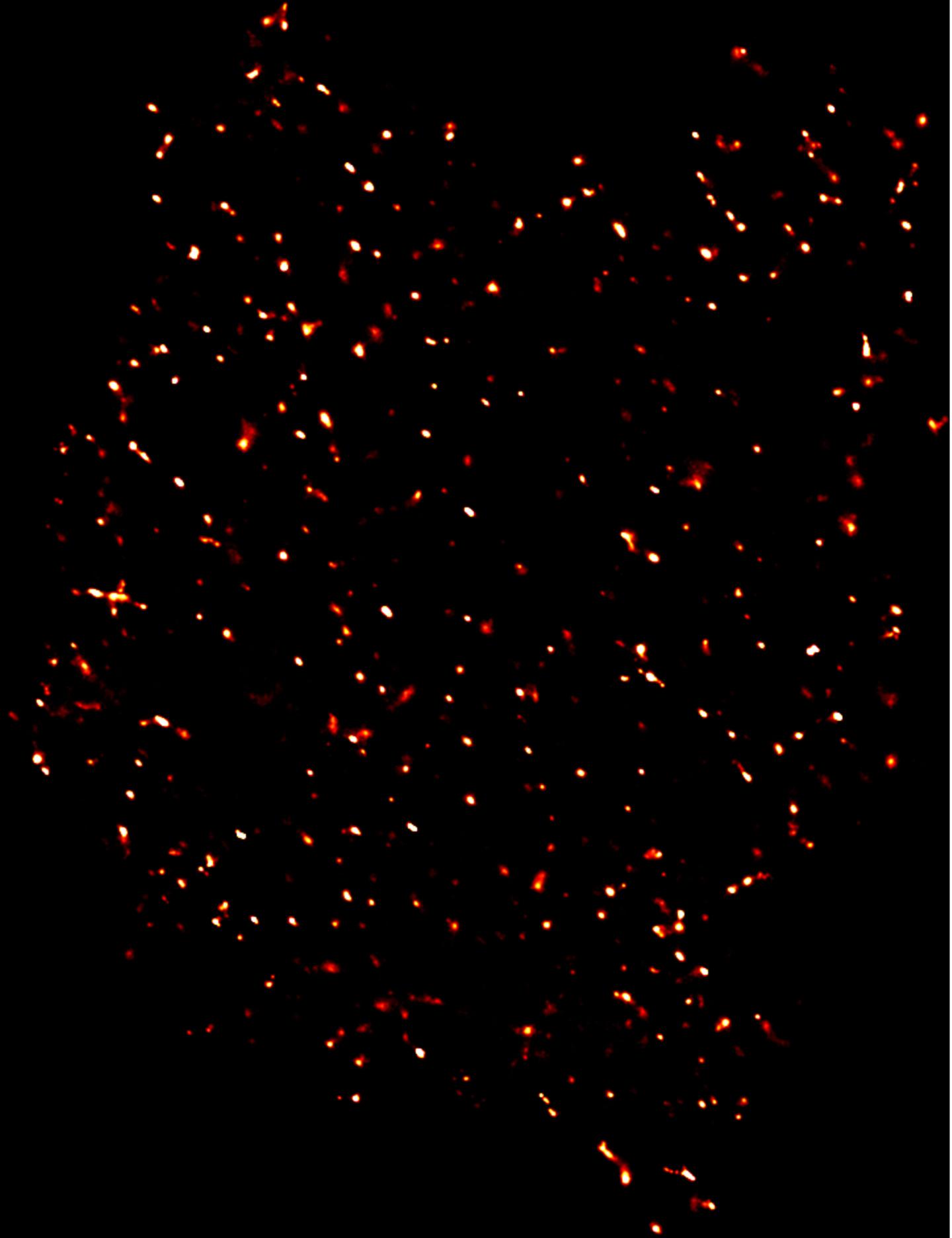 Calcium Channels