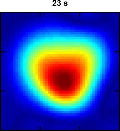 Hyper-SAGE MRI