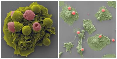 Macrophages