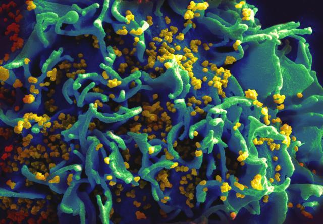 HIV-Infected H9 T Cell