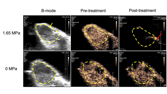 Sidekick Microbubbles Carry Anti-Cancer Drugs, Damage Tumor Vessels #ASA182
