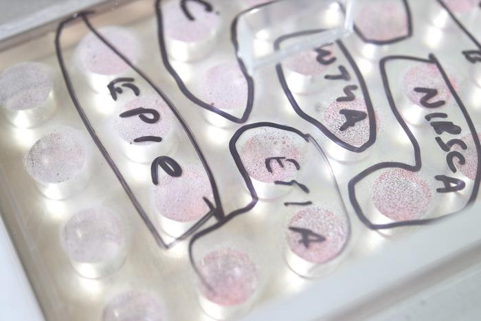 Lab-grown Organoids