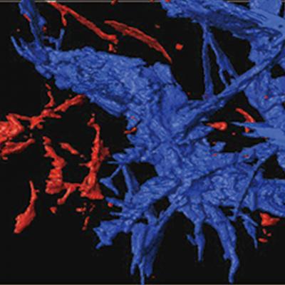 Iron Melt Network
