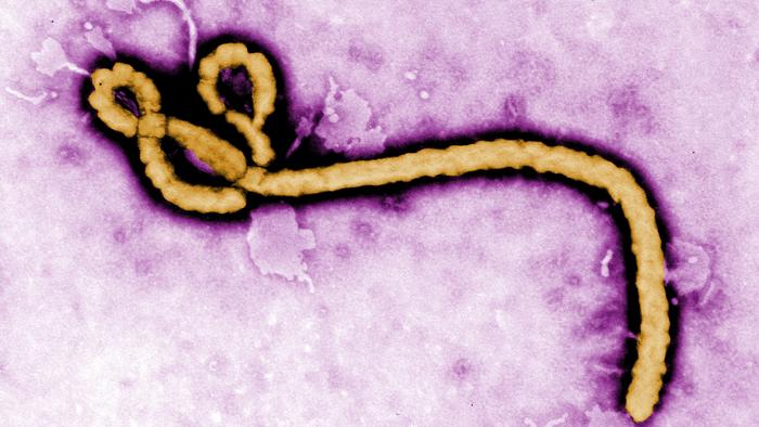 Electron micrograph of an Ebola virus virion