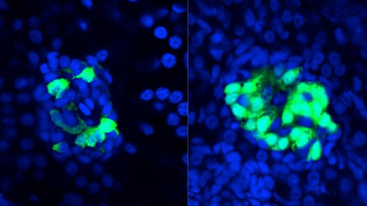Gut Protein's Influence on Beta Cell Populations