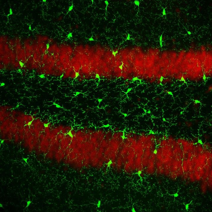 Microglia Cells