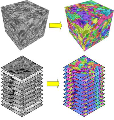 Brain Mapping