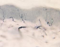 Nerve Fibers