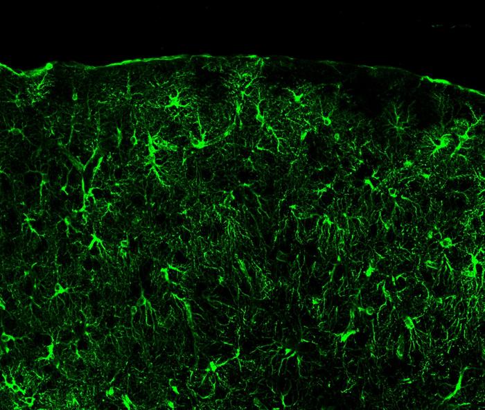 Astrocytes in brain