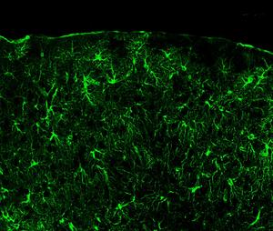 Astrocytes in brain
