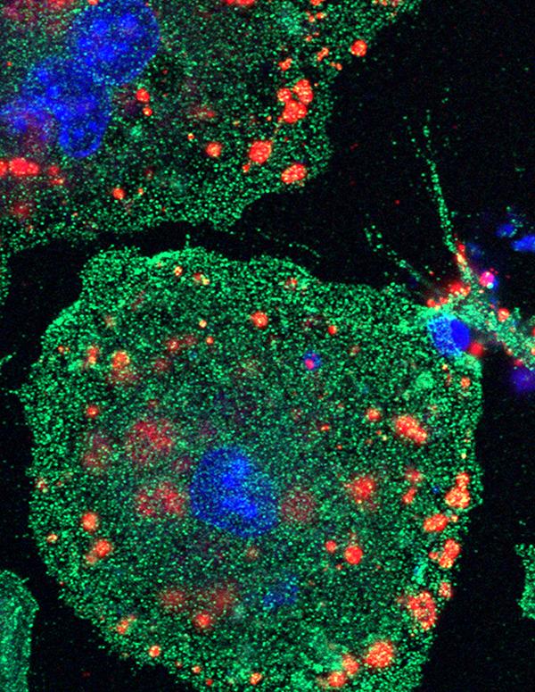 Phagocytic Cell