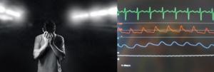 Depression and cardiac biomarkers in brain stimulation therapy.