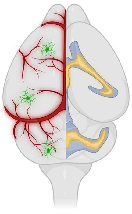 Brain states