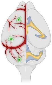 Brain states