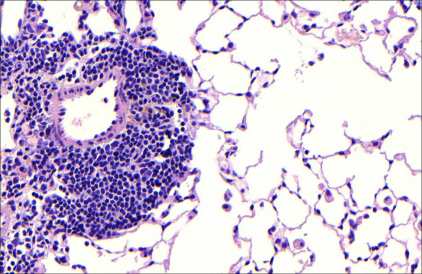 Lung Follicles (2)