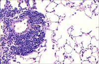 Lung Follicles (2)