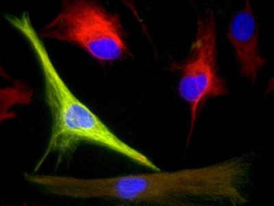 Neural Progenitors
