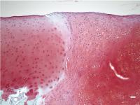 Integration of Transplanted Cells