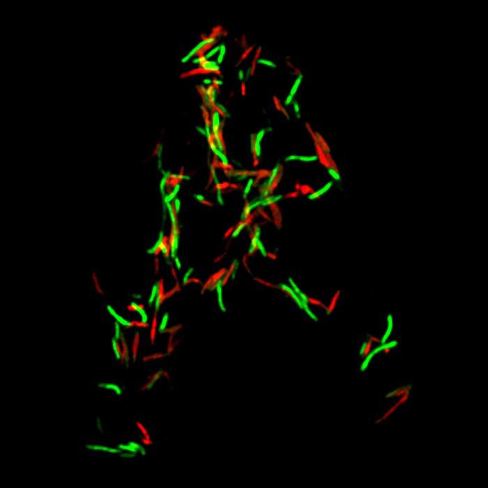 MbcT Toxin Induces Death of <i>Mycobacterium</i> Tuberculosis