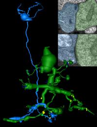 2-D pathoconnectome image: Two retinal neurons