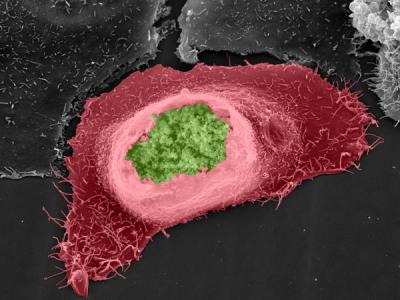 <i>Chlamydia</i>
