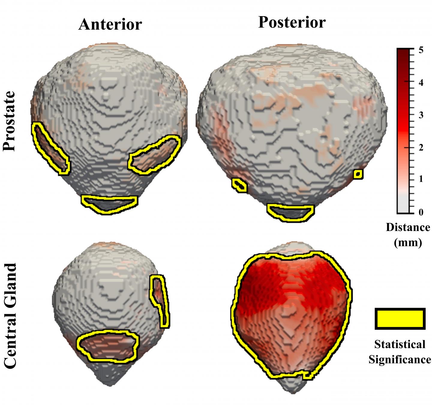 Atlas-Based Population Analysis